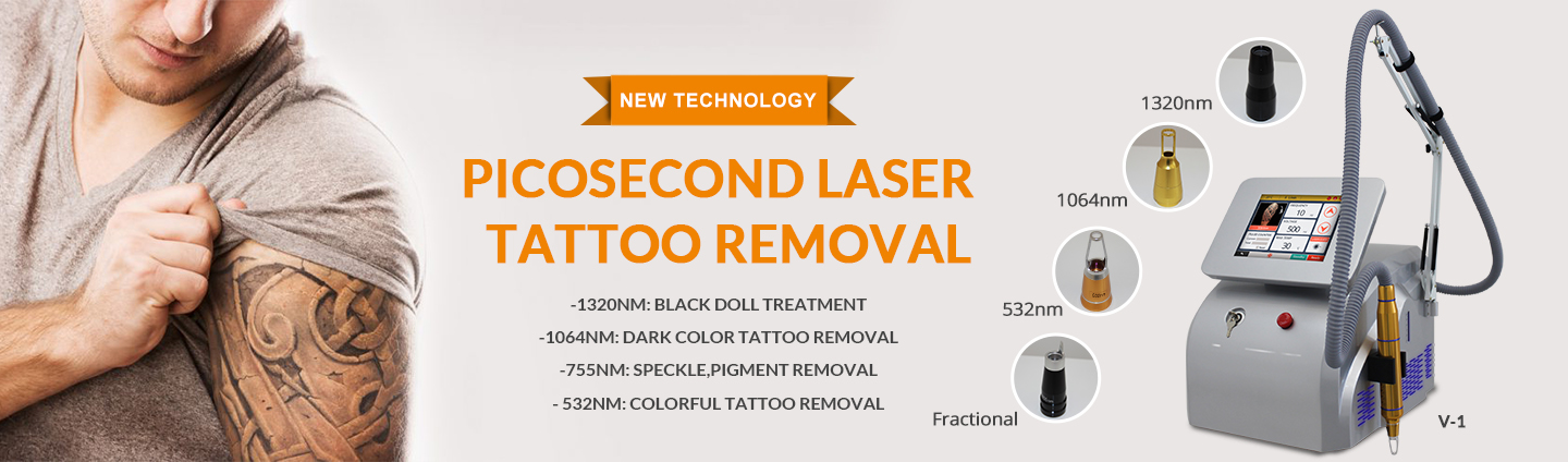 Rimozione tatuaggi con laser a picosecondi