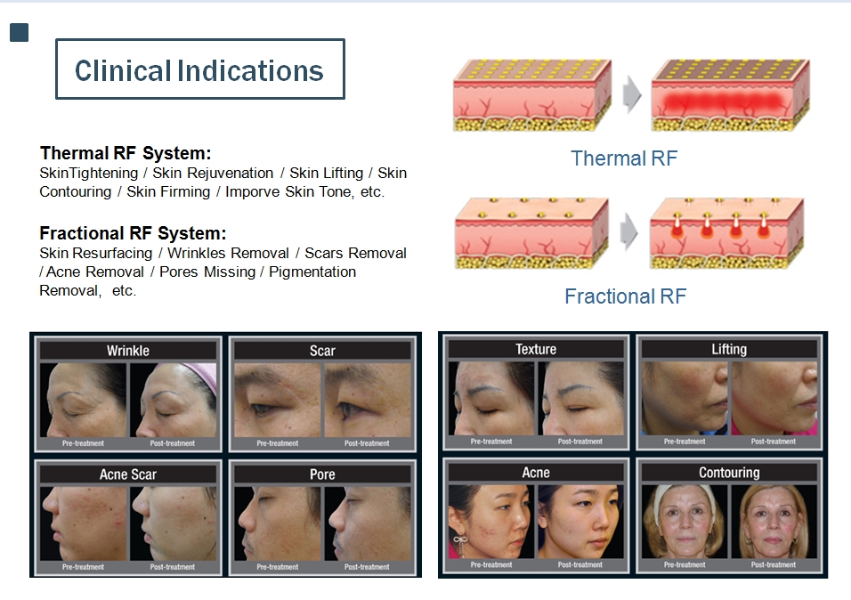 indicazioni cliniche
