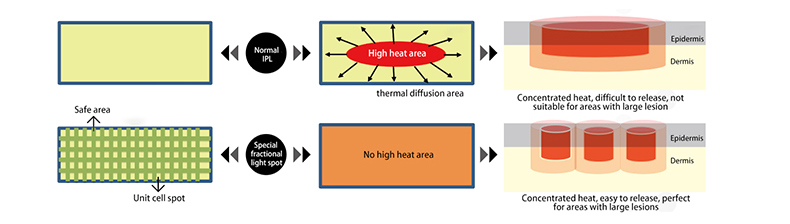 Skin Rejuvenation Machine Macchina per il ringiovanimento della pelle