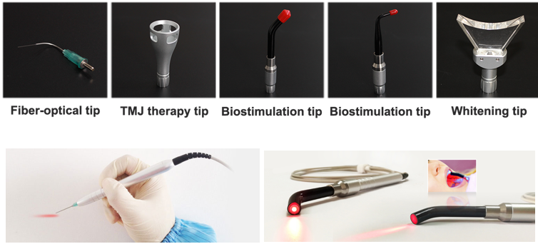 macchina laser dentale