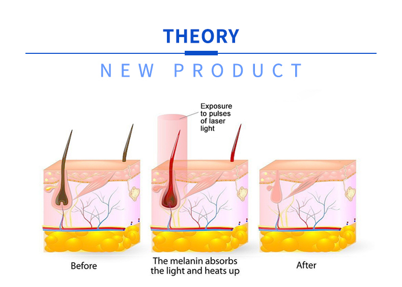macchina per la depilazione