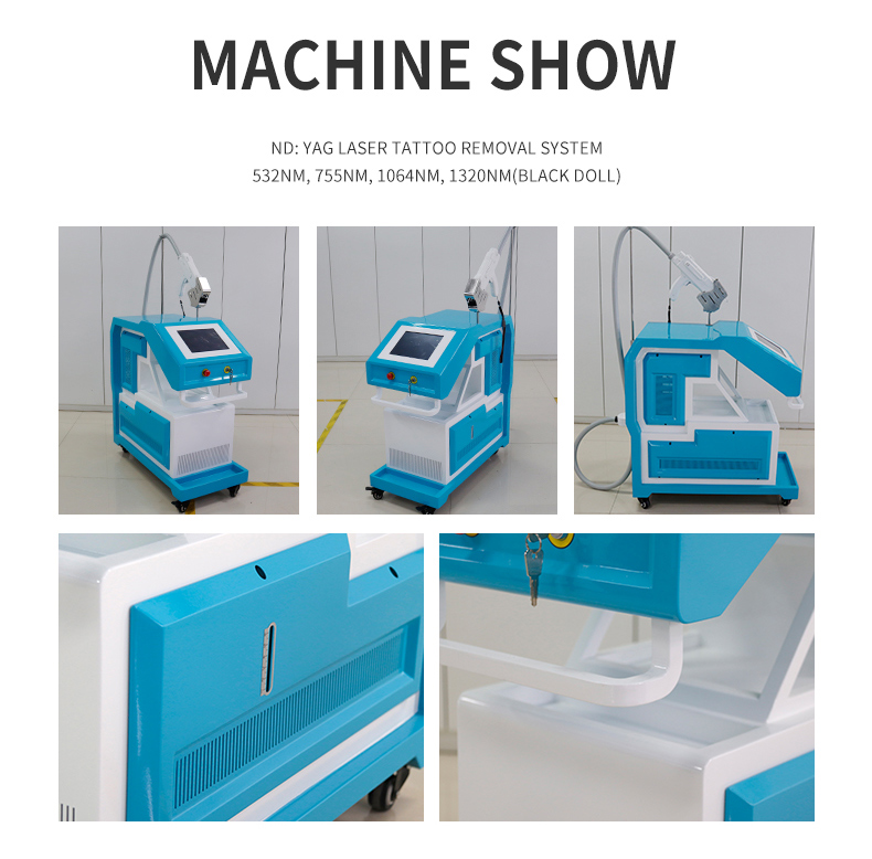 Macchina per la rimozione del tatuaggio