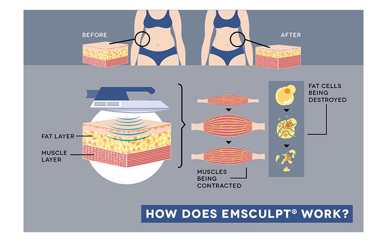 EMS_03_01