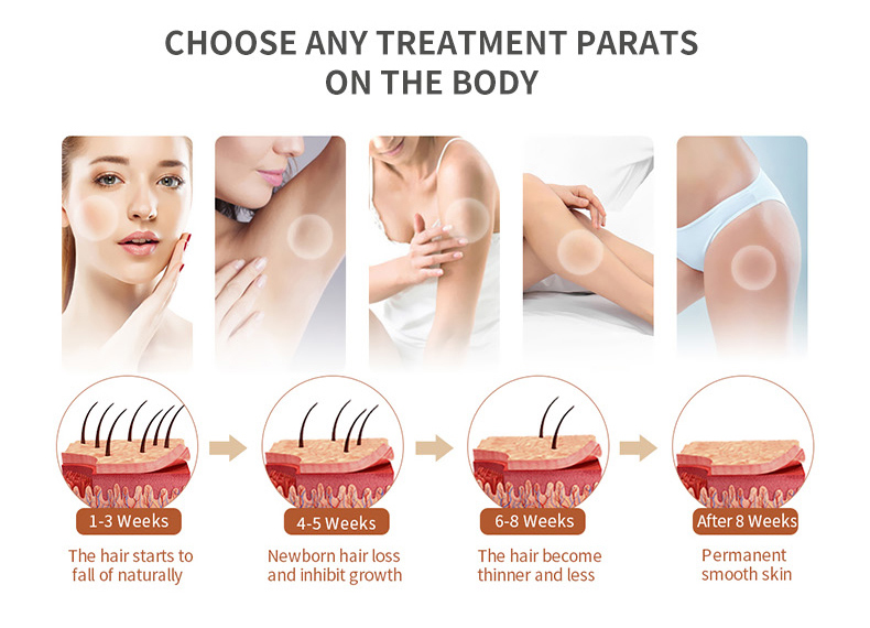 macchina per la depilazione