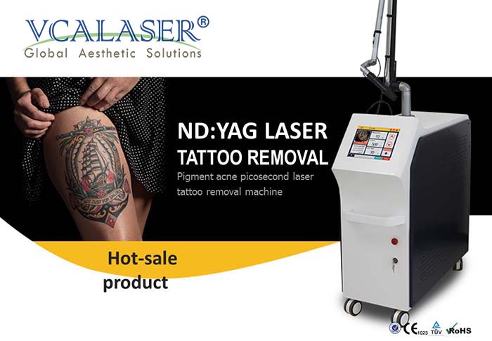 La meraviglia della macchina per la rimozione dei tatuaggi laser a picosecondi