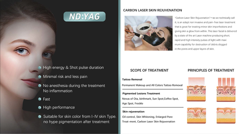 Rimozione del tatuaggio laser