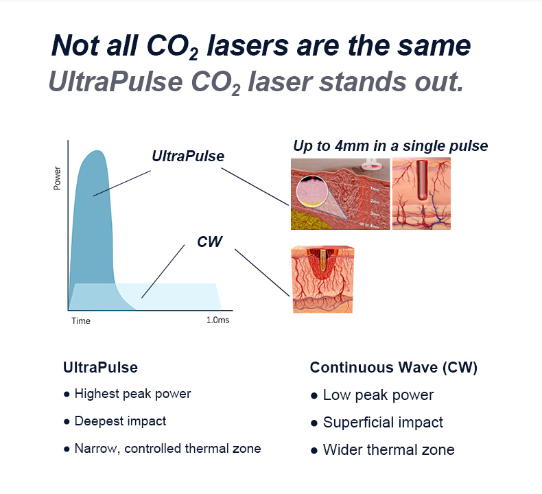 Resurfacing della pelle