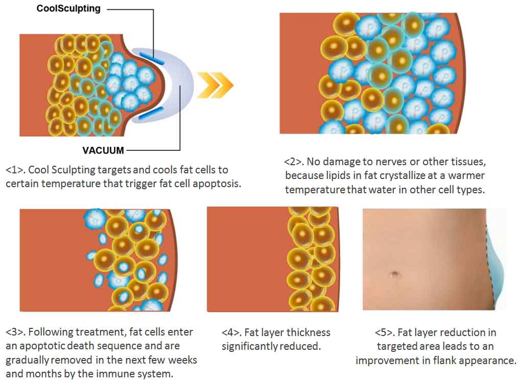 teoria