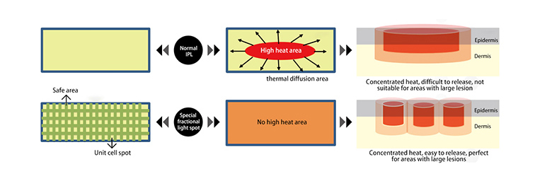 Macchina per il ringiovanimento della pelle professionale