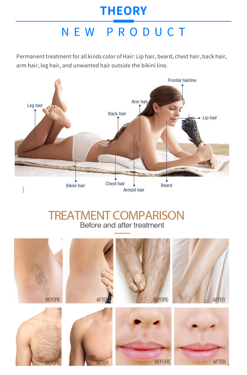 macchina per la depilazione laser