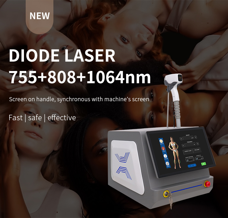 apparecchiature per la depilazione laser