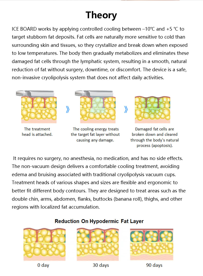 Macchina di dimagrimento del bordo congelato 