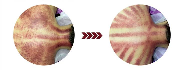 Effetto clinico della DDS