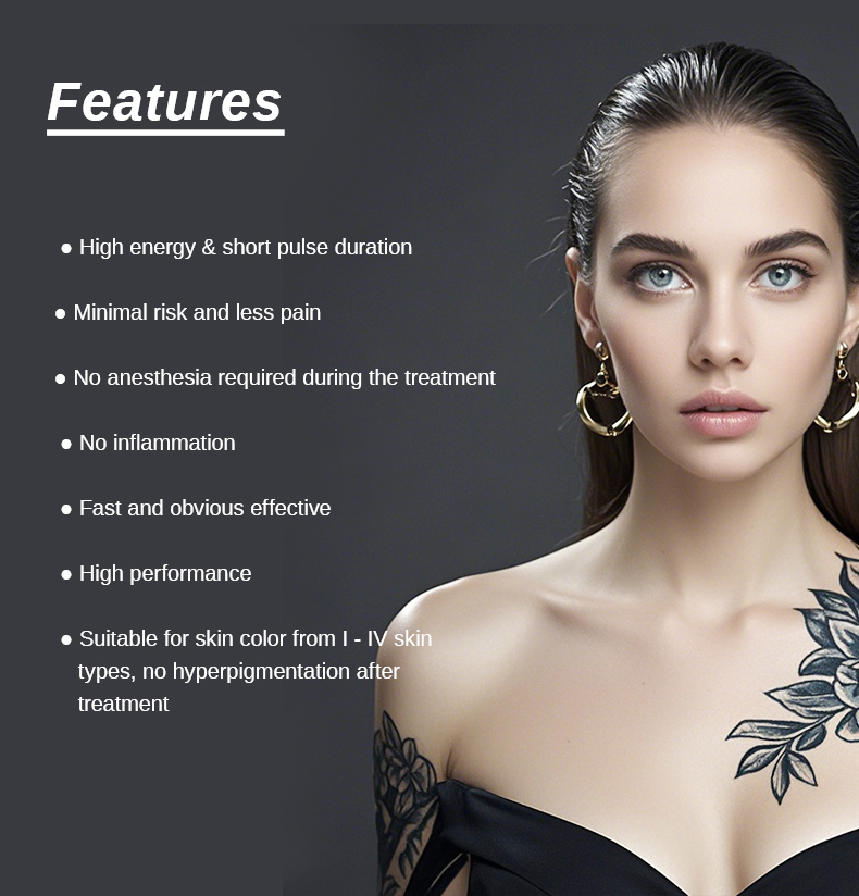 Rimozione del tatuaggio laser