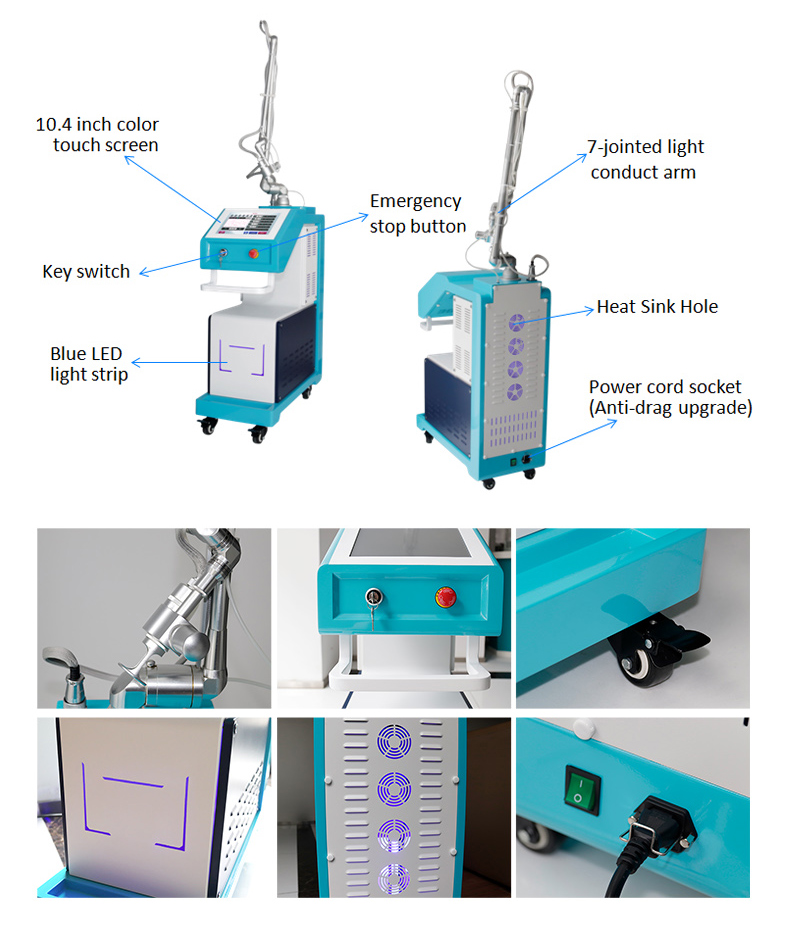 Macchina di serraggio vaginale laser frazionario