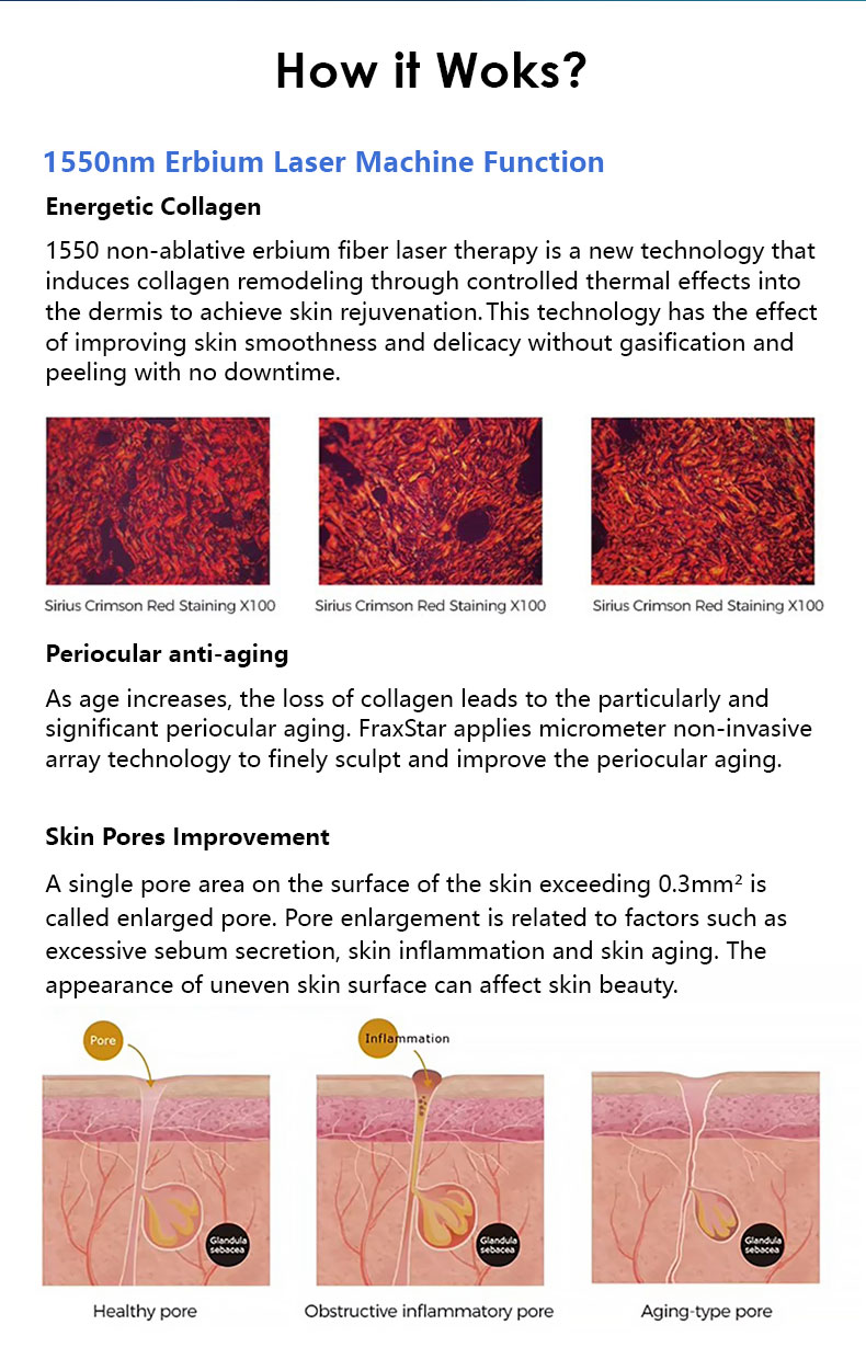 Tonificazione della pelle