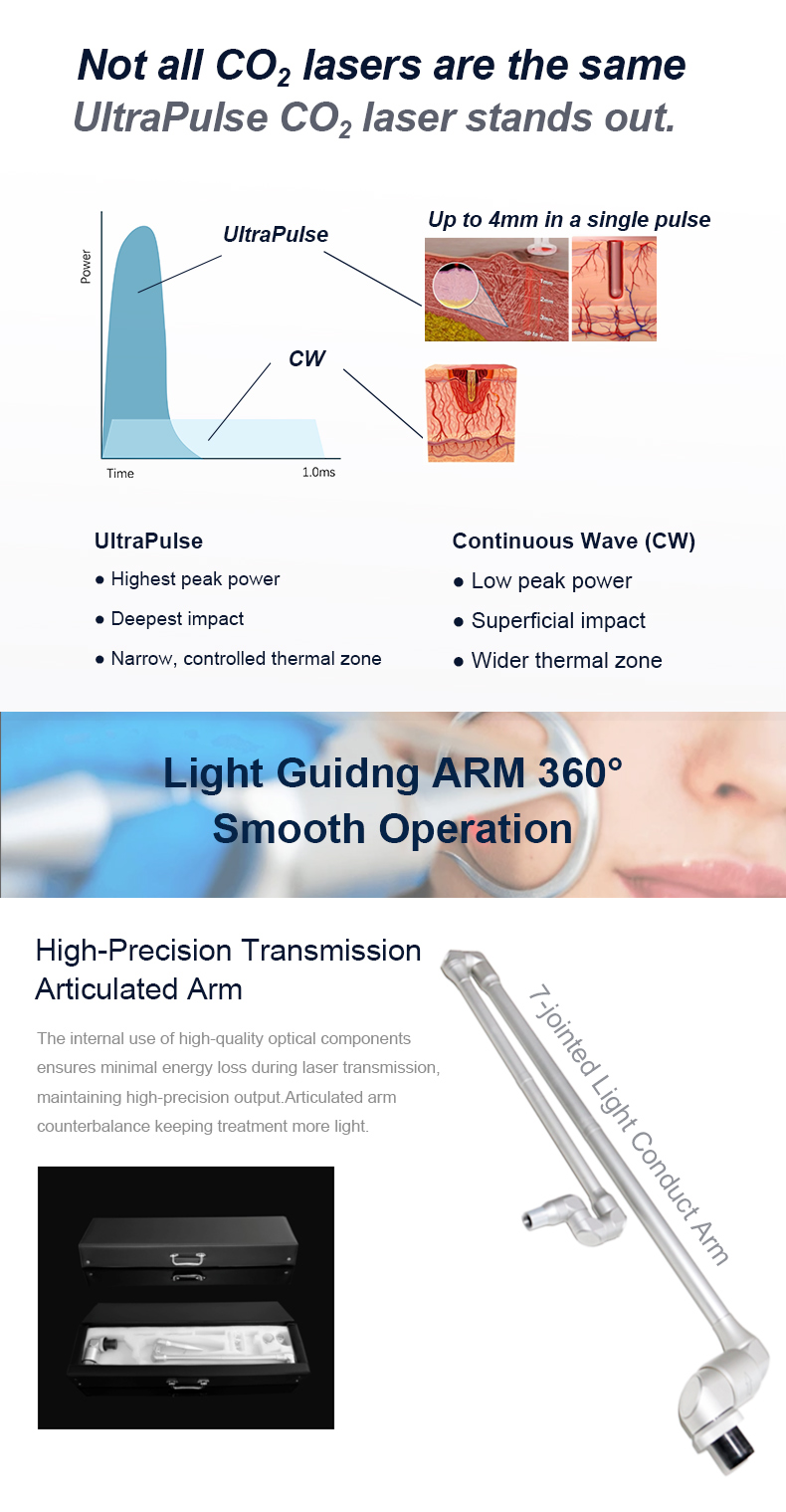 Laser frazionario CO2