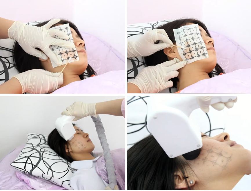 trattamento clinico termale