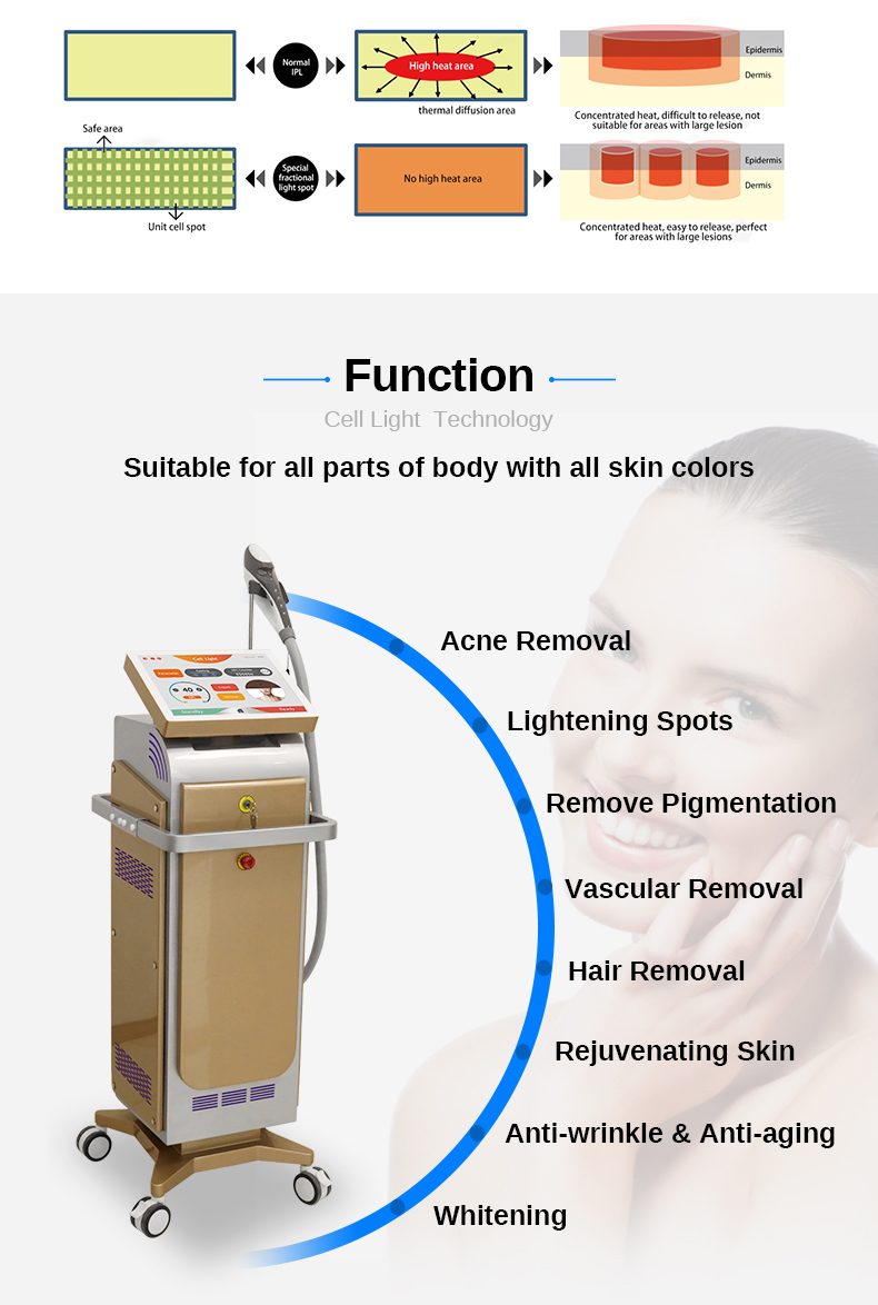 Macchina per la rimozione delle rughe