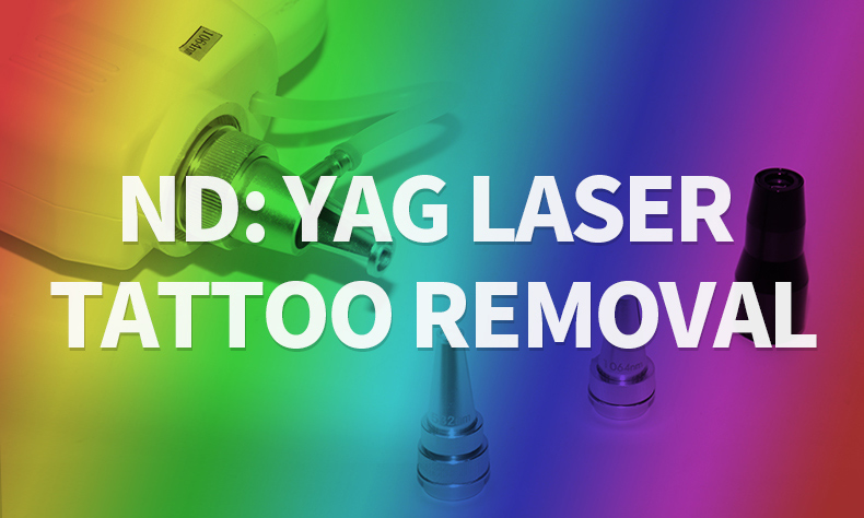 Migliore macchina laser per la rimozione del tatuaggio
