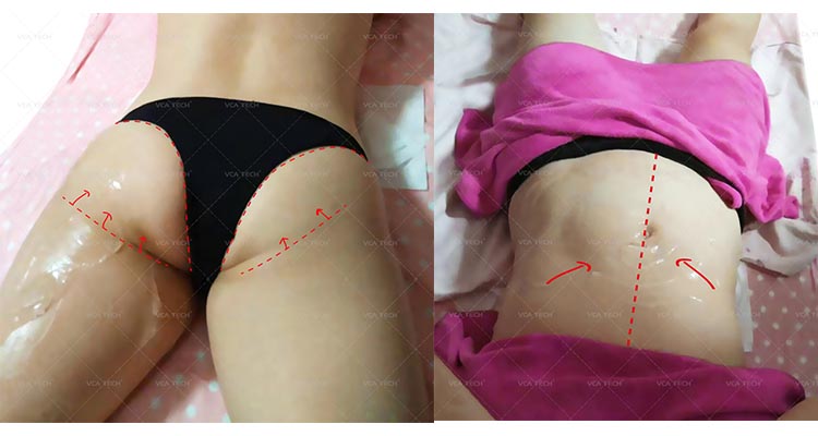 Macchina per la rimozione delle rughe