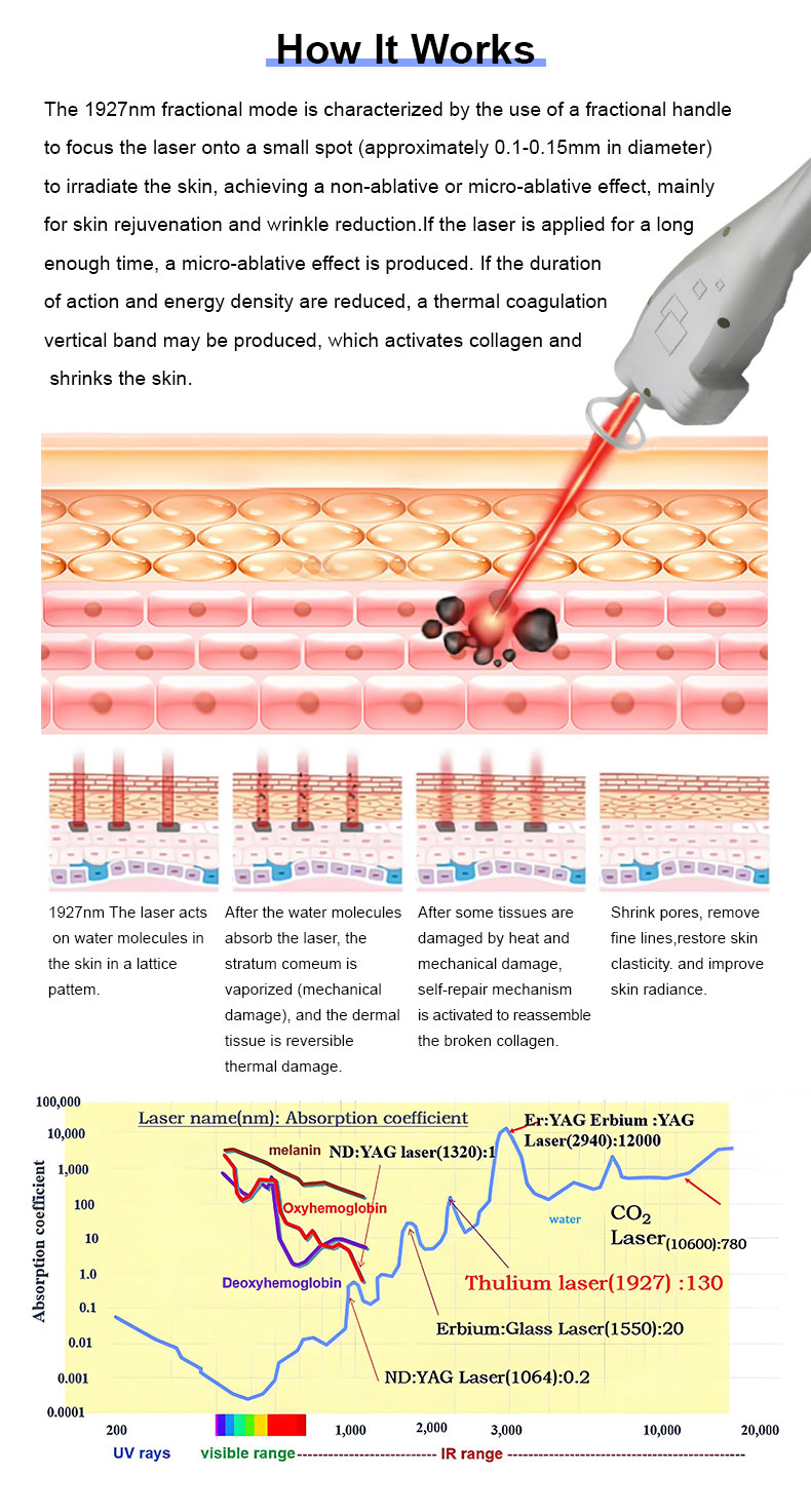 Laser frazionario di THULIO 1927nm