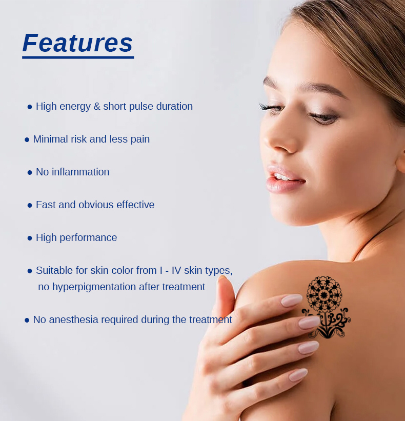 Macchina per la rimozione del tatuaggio