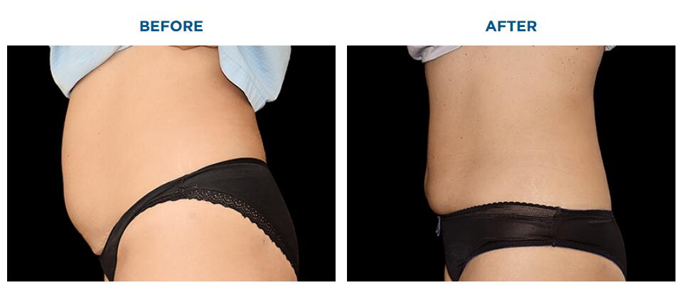 macchina per la perdita di peso