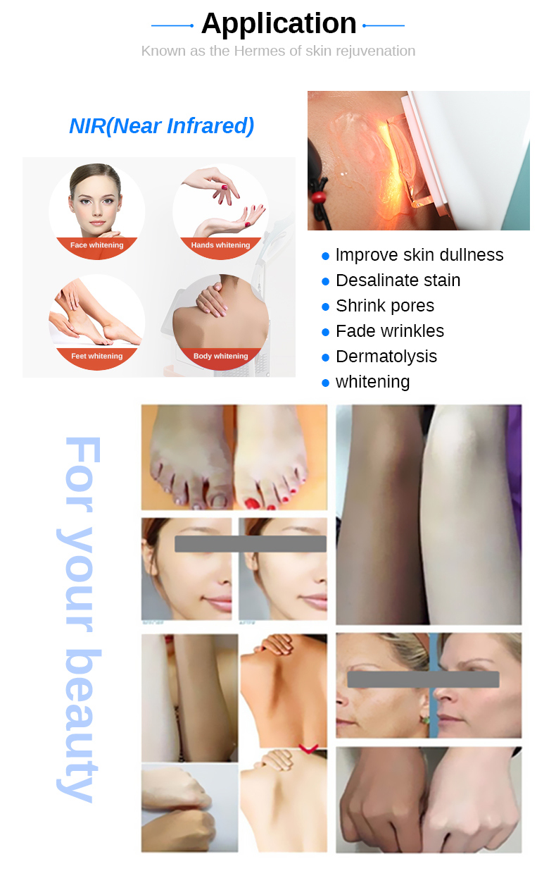 Migliore macchina sbiancante efficace 