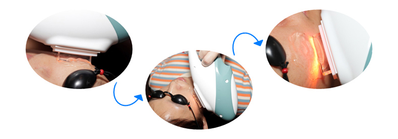 Migliore macchina sbiancante efficace