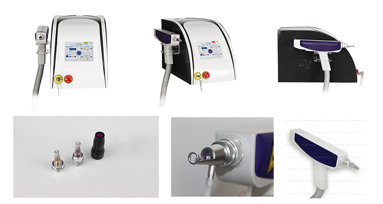 rimozione del tatuaggio laser