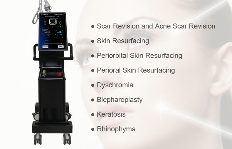 Laser frazionario CO2
