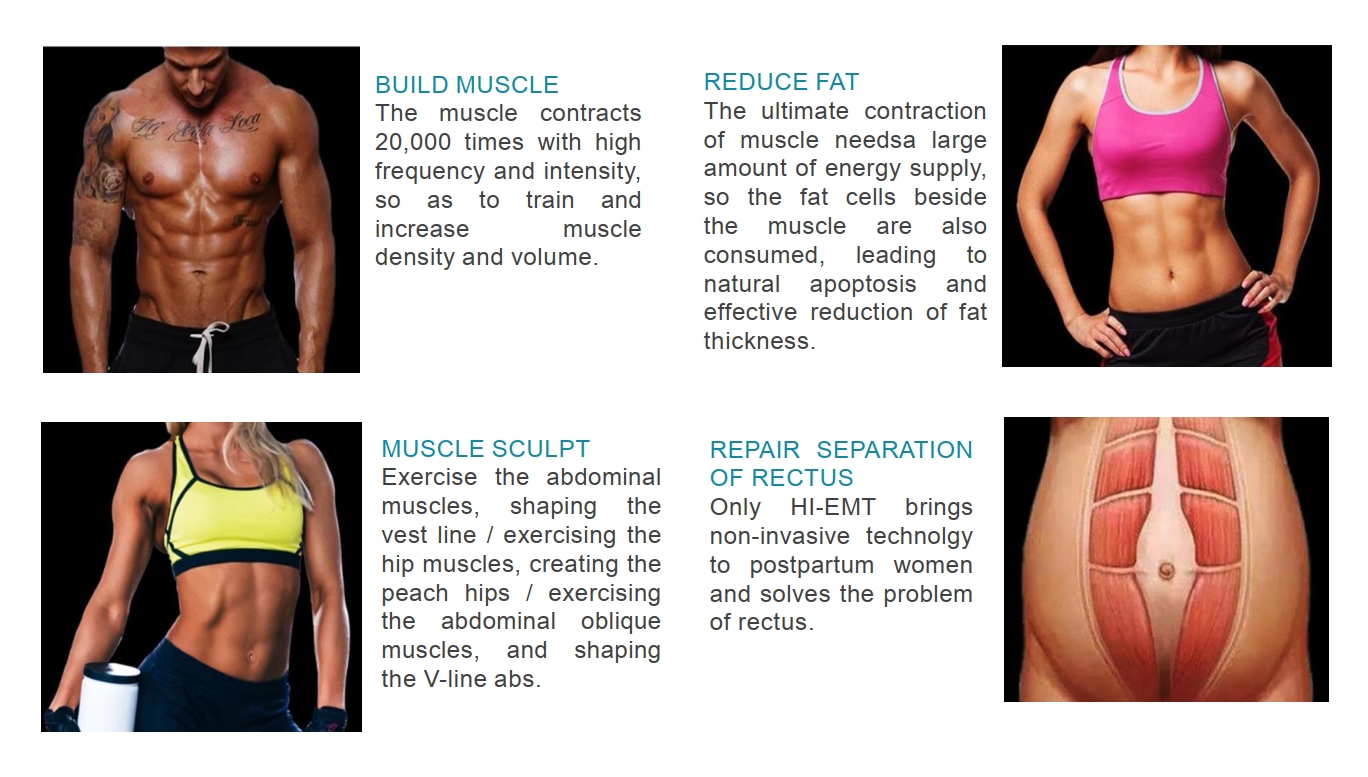 Applicazioni EMSCULPT