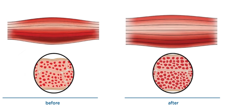 Gli EMS costruiscono i muscoli