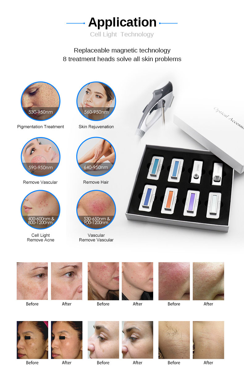 Macchina per la rimozione delle rughe