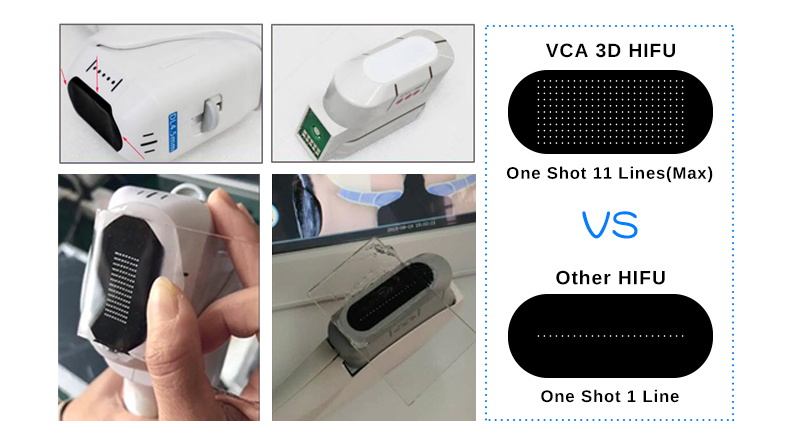 macchina per la rimozione delle rughe per hifu