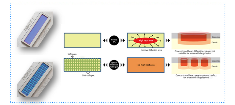 2. Due forme di produzione di densit&agrave;, spot a nido d'ape e spot di luce frazionaria speculare, tecnologia di trasmissione istantanea a nido d'ape, migliorano la sicurezza del trattamento clinico di grande area
