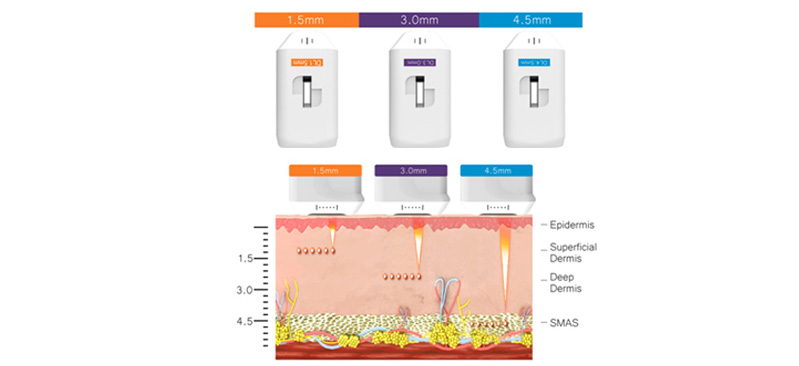 Macchina hifu professionale