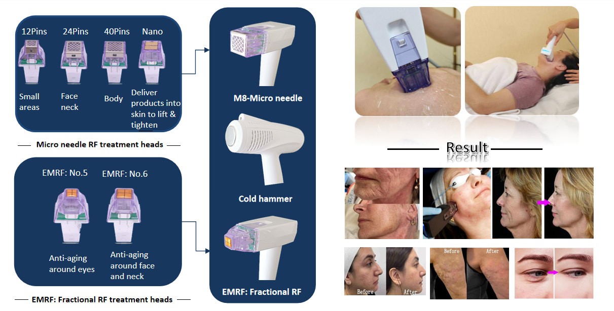 Micro Needle Machine