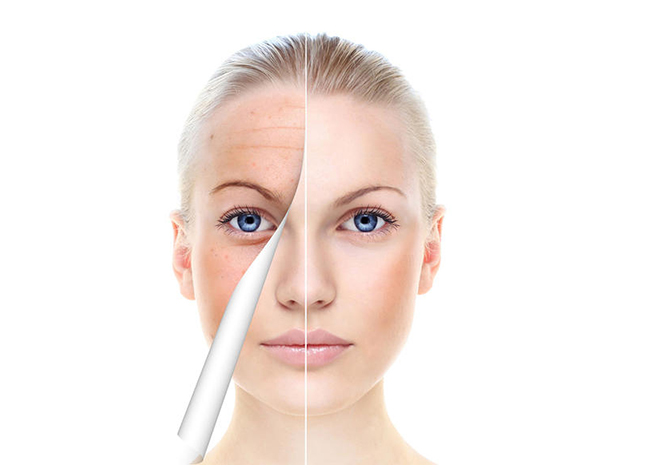 Macchina per la rimozione delle rughe ad ultrasuoni 3D Hifu Body Slimming 