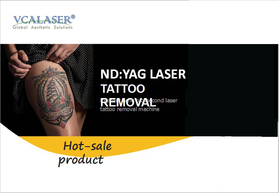 macchina per la rimozione dei tatuaggi