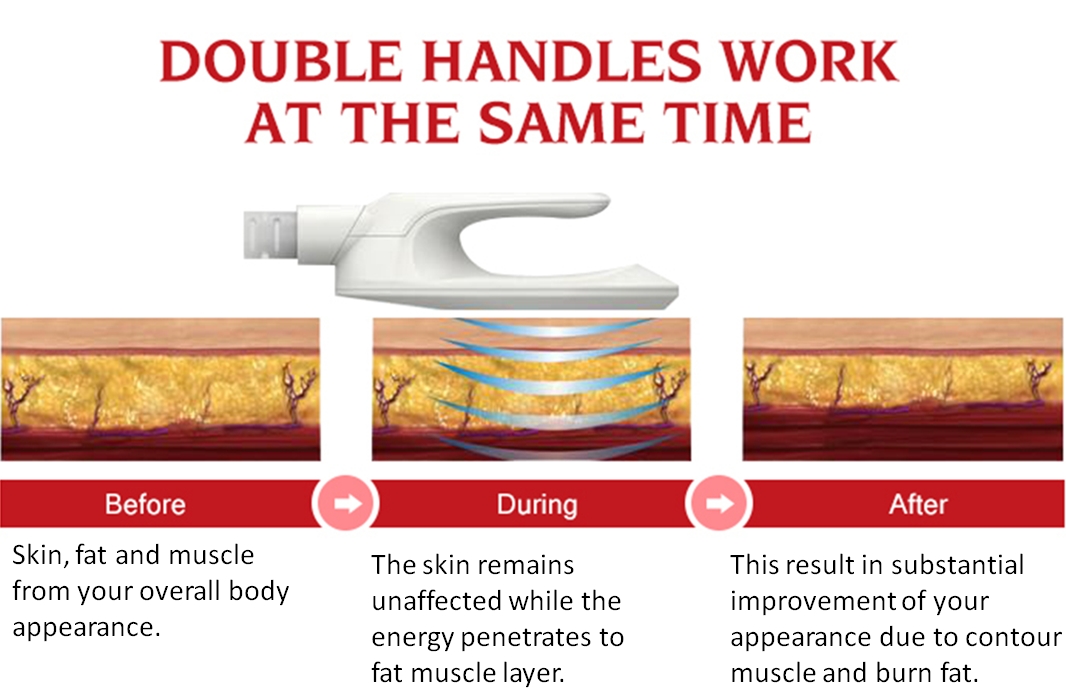 Macchina per scolpire EMS