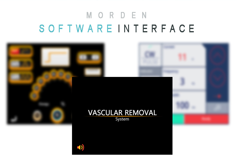 Macchina per la rimozione delle vene del ragno