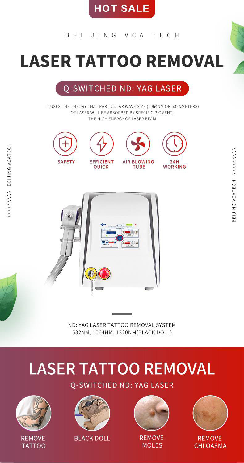 Rimozione del tatuaggio laser