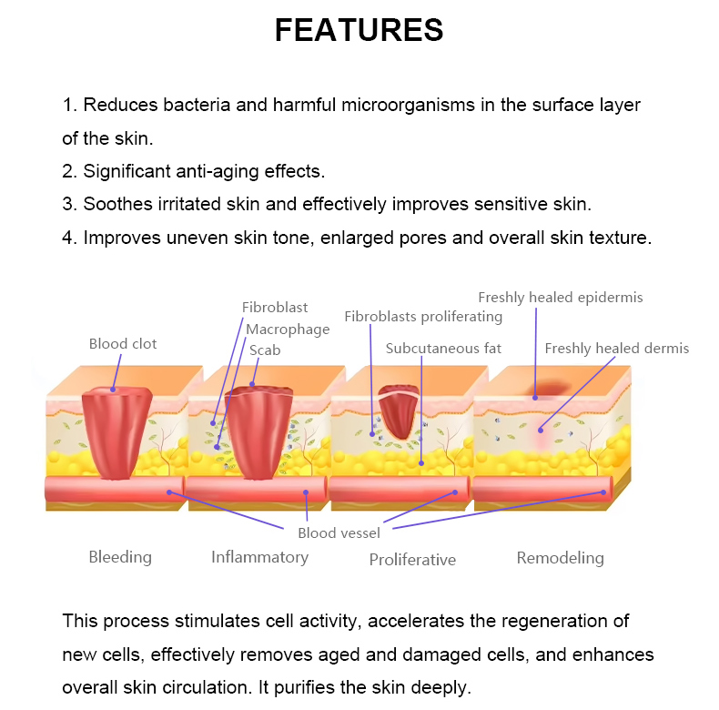 Macchina per plasma freddo