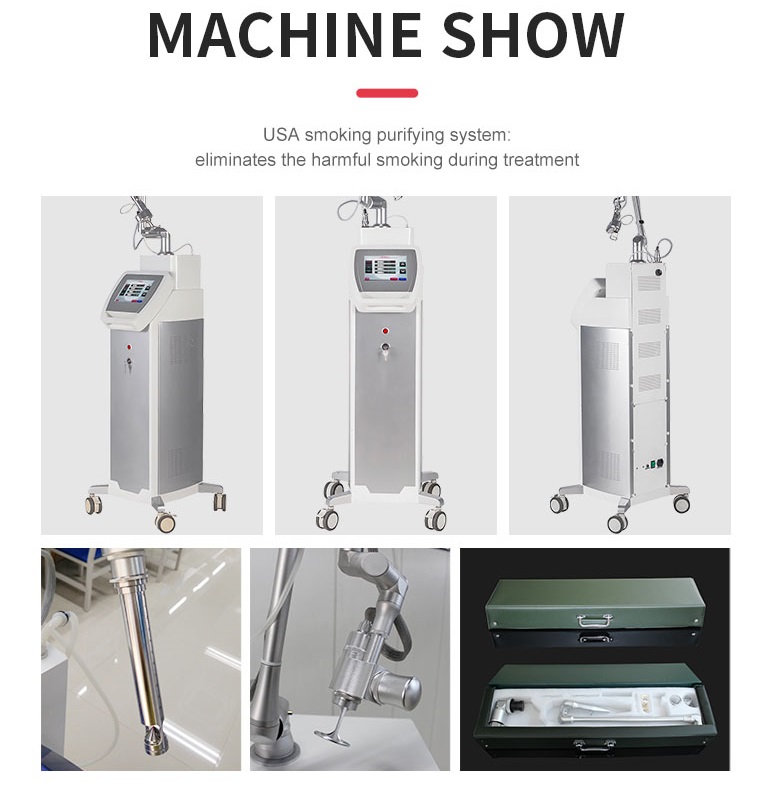 Laser CO2 frazionario