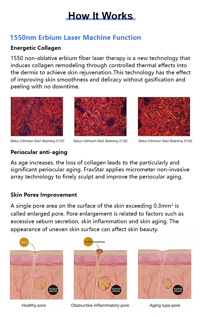 Laser di vetro Erbium