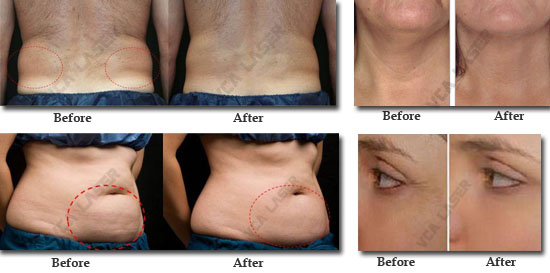 trattamento-MARK550(6)