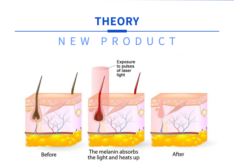 macchina per la depilazione