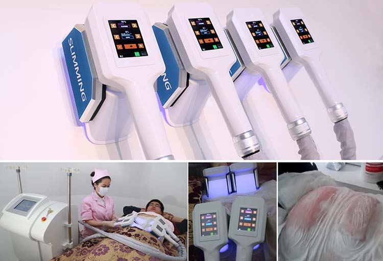 macchina coolsculpting